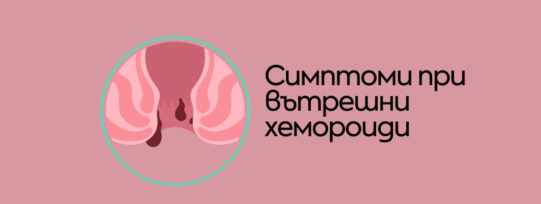 Симптоми при вътрешни хемороиди