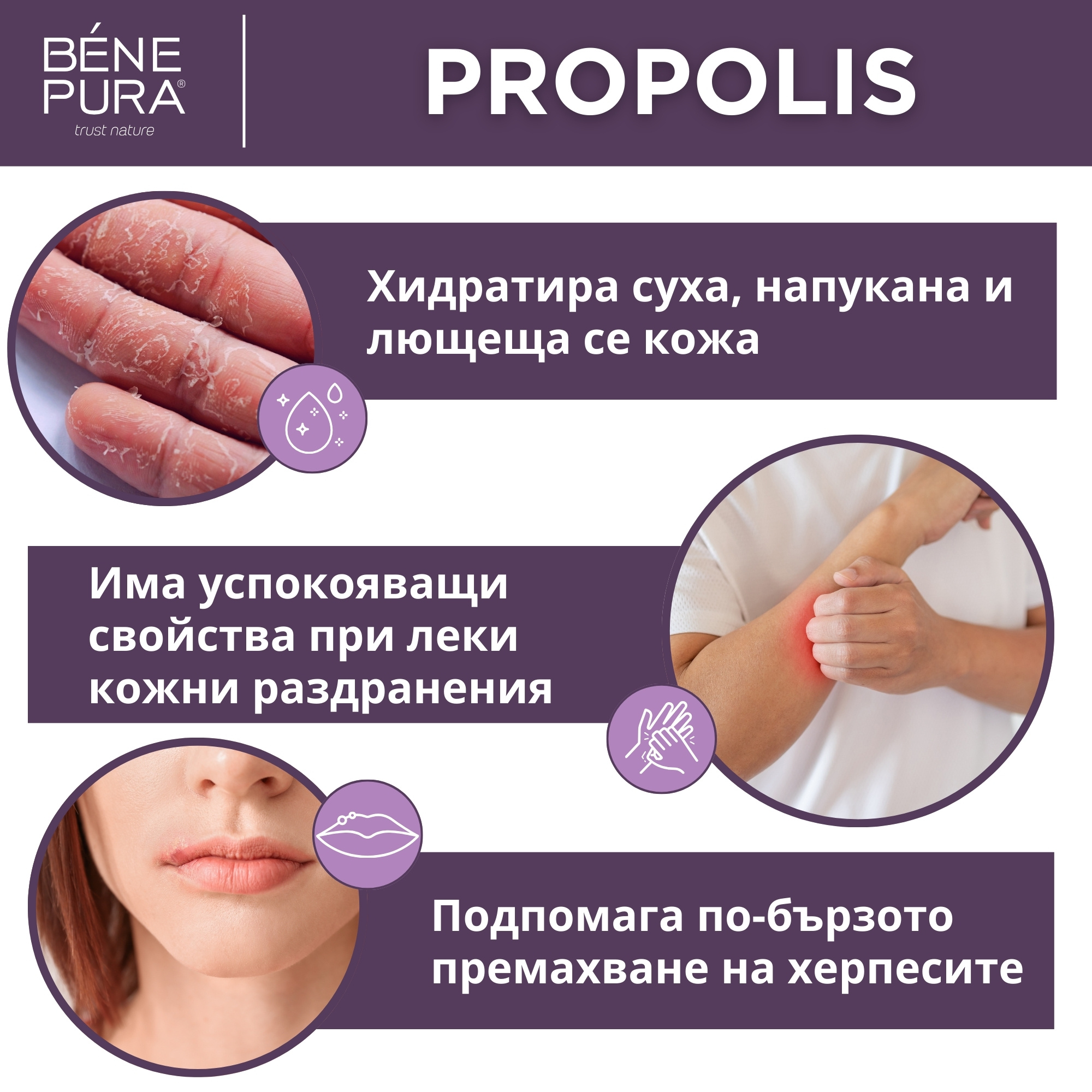 Мехлем Прополис - Мехлем с Прополис 30% при Кожни раздразнения - 40мл